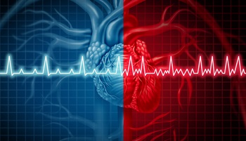 Atrial fibrillation illustration