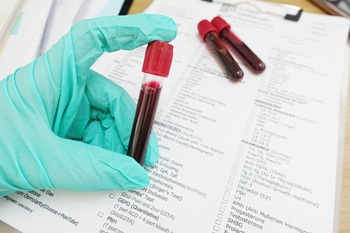 tube of blood