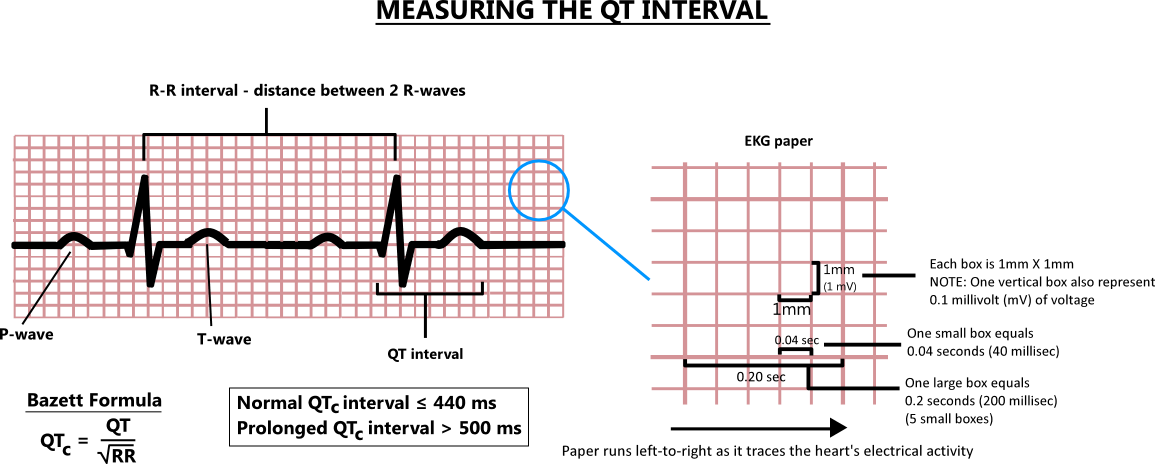 Illustration of the corrected QT interval calculations using the Bazett formula