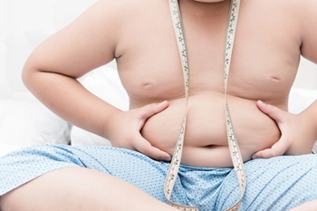 Obese child holding gut