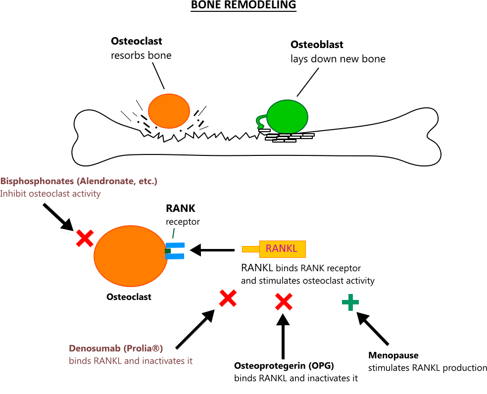 Osteoporosis