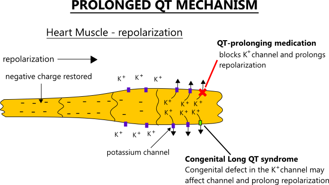 illustration of the mechanism behind QT-interval prolongation