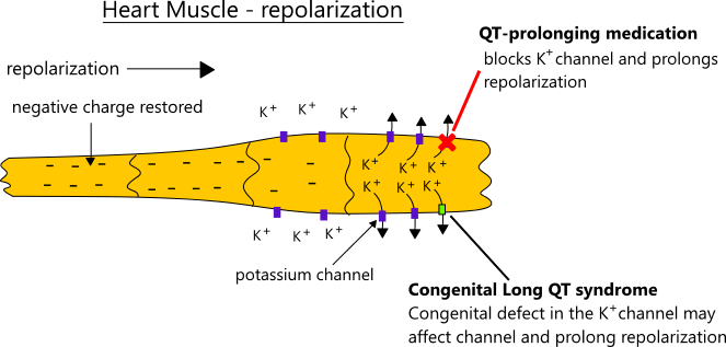 Illustration of prolonged QT interval mechanism