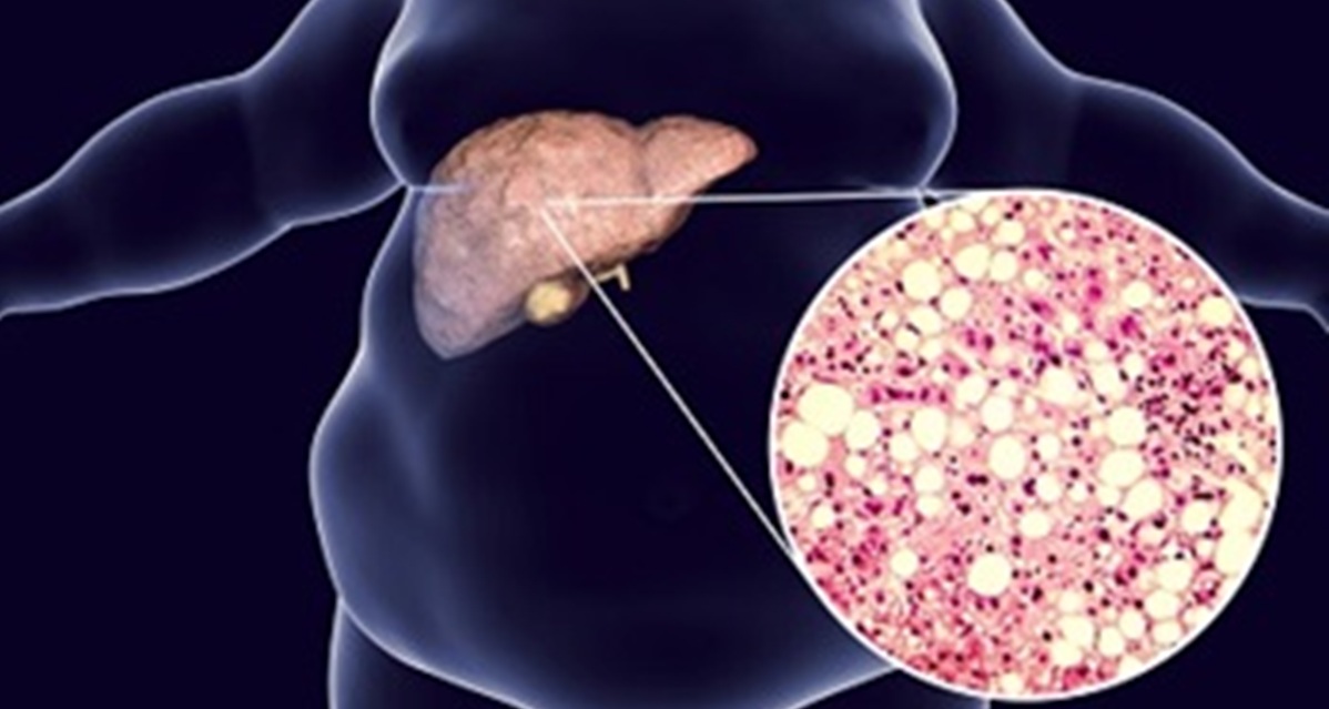 semaglutide arm injection Where and How to Inject Semaglutide: A Comprehensive Guide